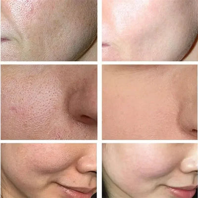 Sakura Bloom Radiance Cream™