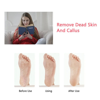 SmoothSole™ Rechargeable Foot File