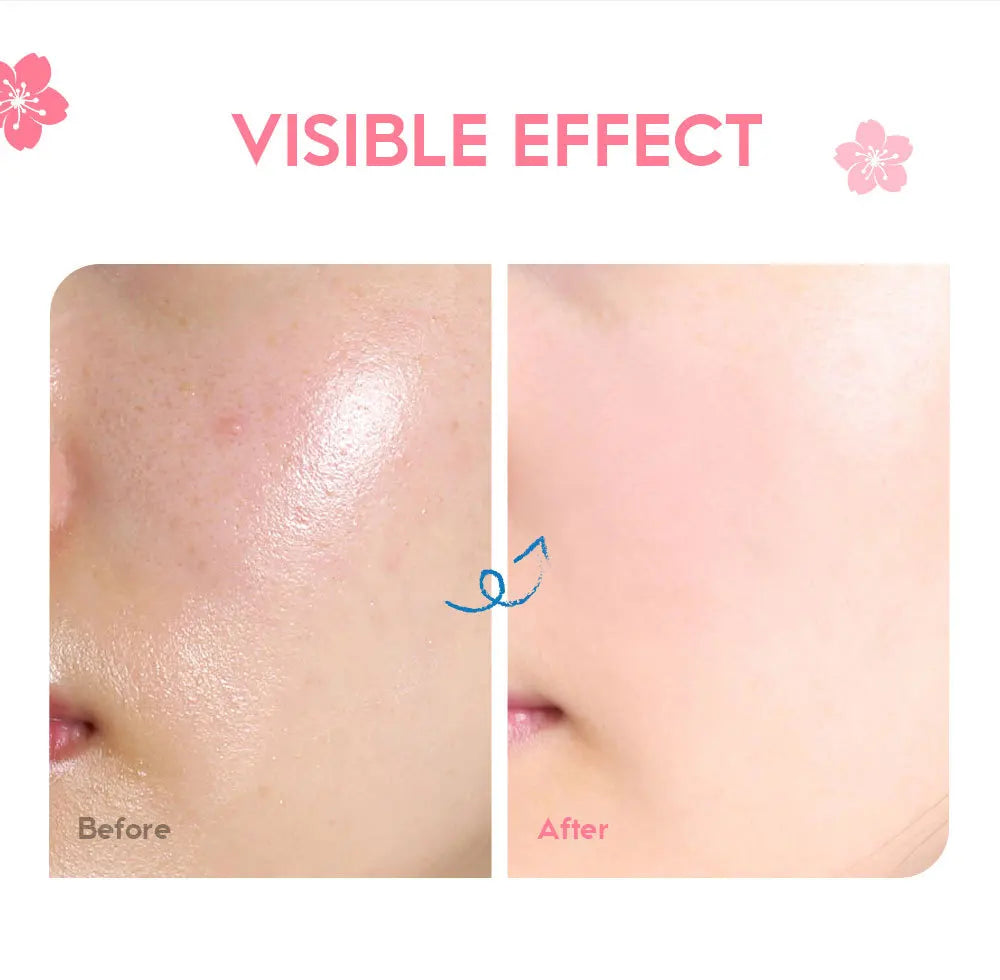 Sakura Bloom Radiance Cream™