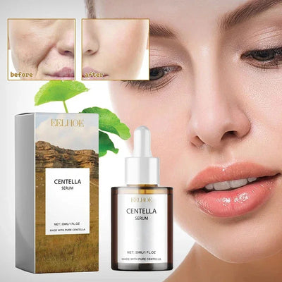 Cica Dew Rejuvenating Serum™